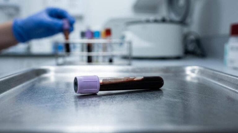 Análisis de laboratorio: qué hay que tener en cuenta en primer lugar